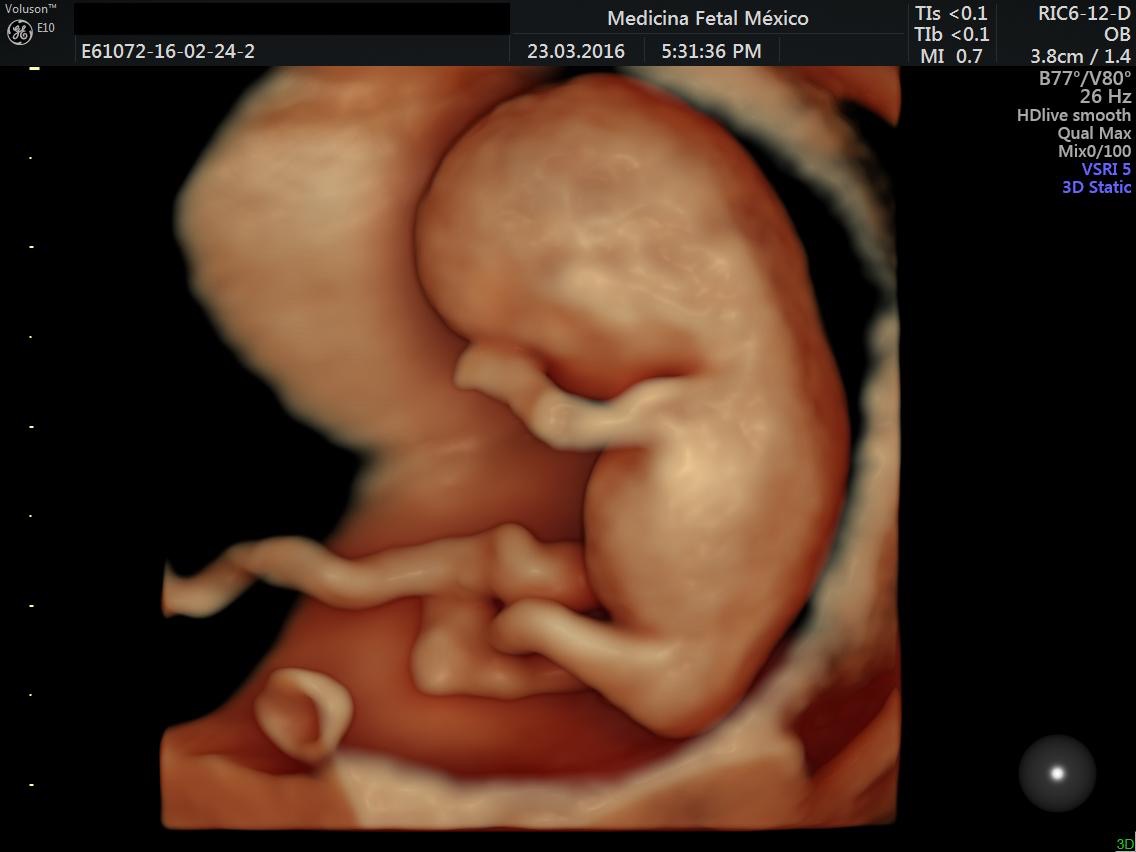 En Medicina Fetal México estamos siempre a la vanguardia en tecnología